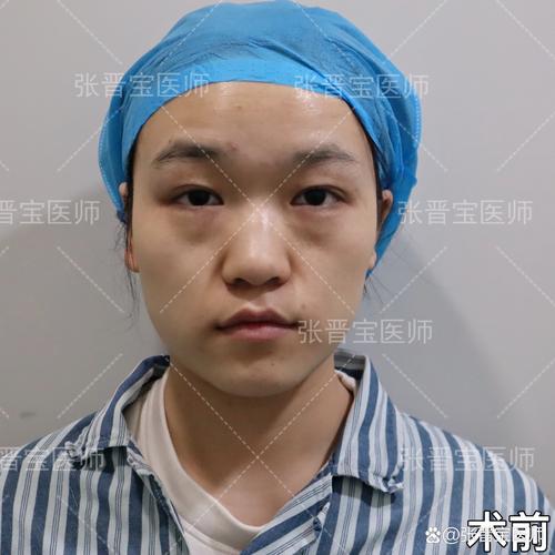 广东省电视台李咏简历